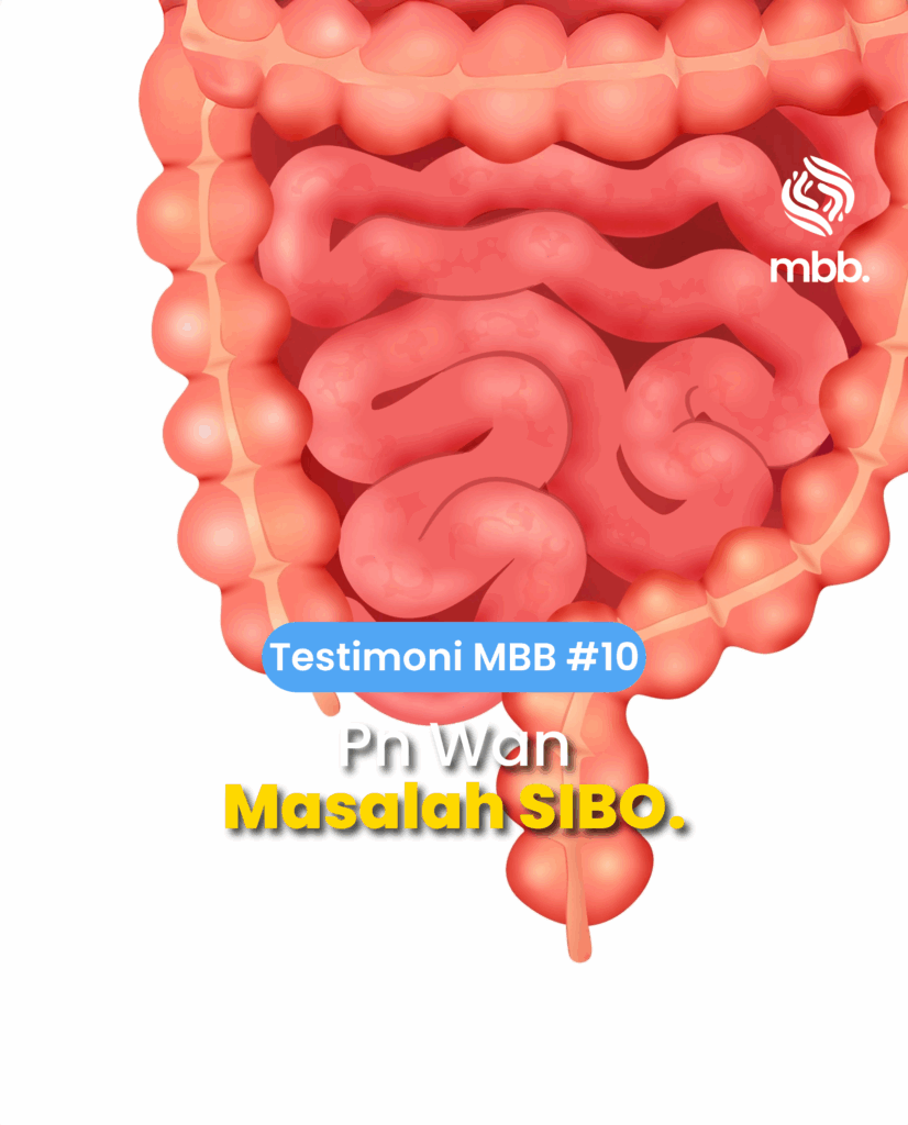 Testimoni MBB #10: Pn Wan, SIBO